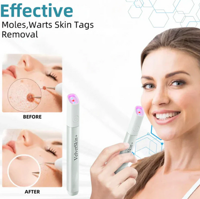 Skin Care Laser Pen