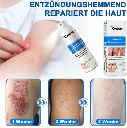 Hypochlorous Facial Spray for Acne & Redness Relief