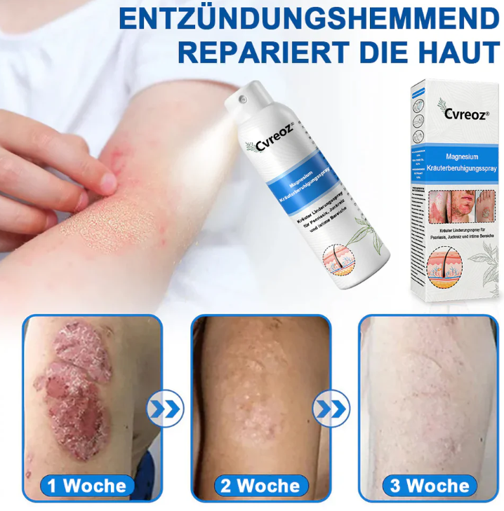 Hypochlorous Facial Spray for Acne & Redness Relief