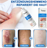 Hypochlorous Facial Spray for Acne & Redness Relief