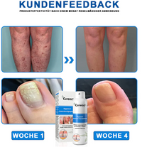 Hypochlorous Facial Spray for Acne & Redness Relief