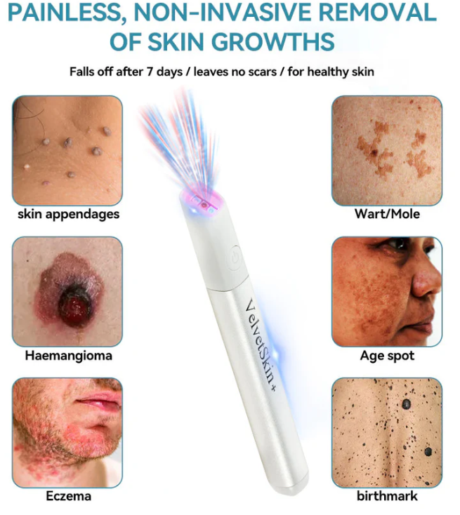 Skin Care Laser Pen