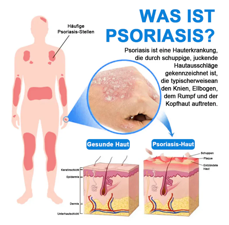 Hypochlorous Facial Spray for Acne & Redness Relief