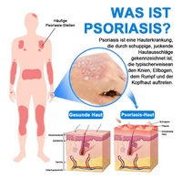 Hypochlorous Facial Spray for Acne & Redness Relief