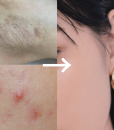 Heal irritation. Brighten tone. Reveal your true skin.