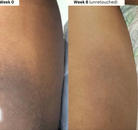 Lemon Turmeric Brightening Body Soap