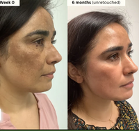 Lemon Turmeric Brightening Body Soap