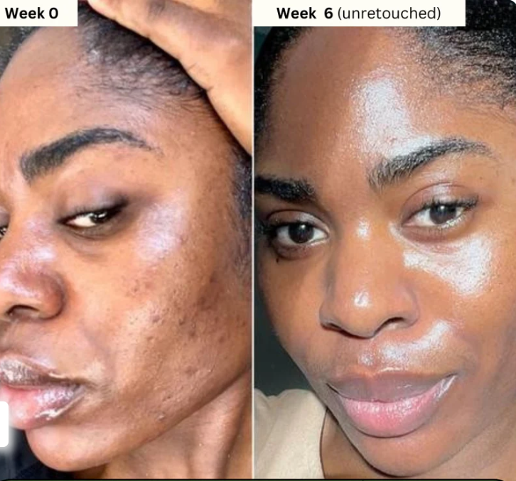 Lemon Turmeric Brightening Body Soap