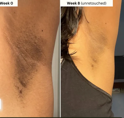 Lemon Turmeric Brightening Body Soap