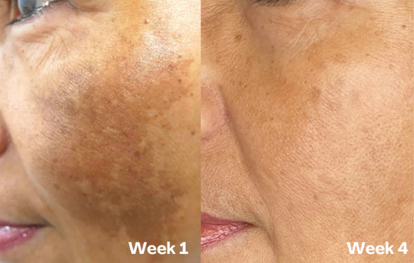 Lemon Turmeric Brightening Body Soap