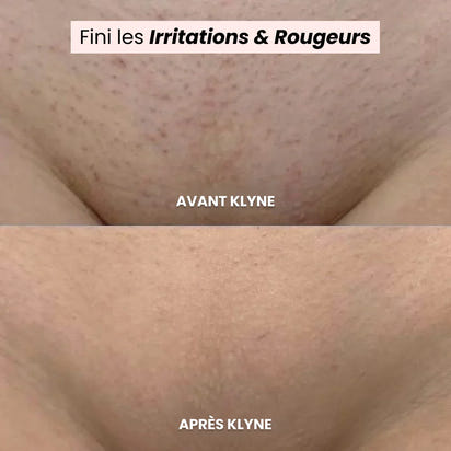 Smooth Skin, Instantly Painless Electric Shaver for Women