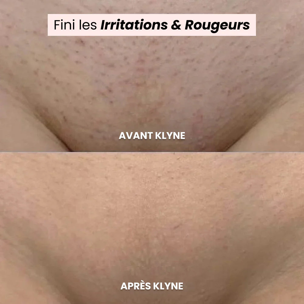 Smooth Skin, Instantly Painless Electric Shaver for Women