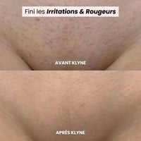 Smooth Skin, Instantly Painless Electric Shaver for Women